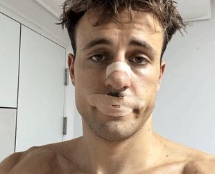 Social media fad of mouth taping during sleep may pose serious risks: Study