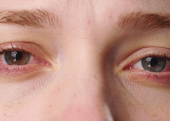 Just 1 hour of social media reels on smartphones can cause eye fatigue: Study