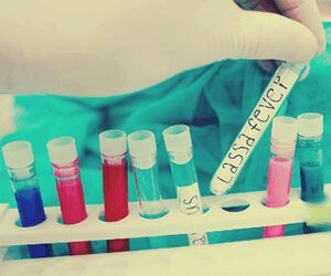 Lassa fever death toll in Nigeria rises to 172