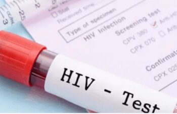 424 living with HIV/AIDS in Mongolia