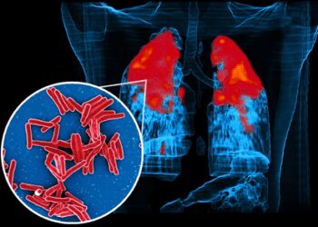 IIT Bombay study shows how TB bacteria shield themselves from antibiotics, stay alive longer