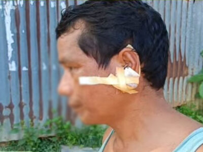 Son Allegedly Attacks Father with Sharp Weapon Over Money for Drugs