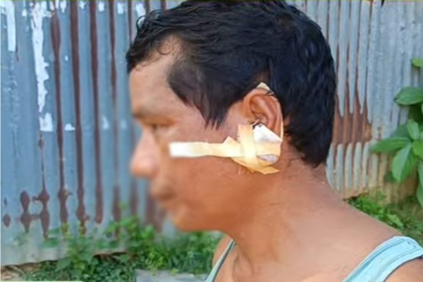 Drug addiction at Gandatwisa in Tripura